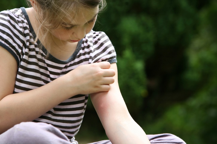 girl scratching her mosquito bite