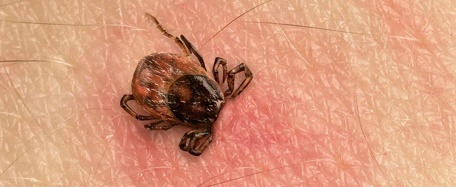 Ticks